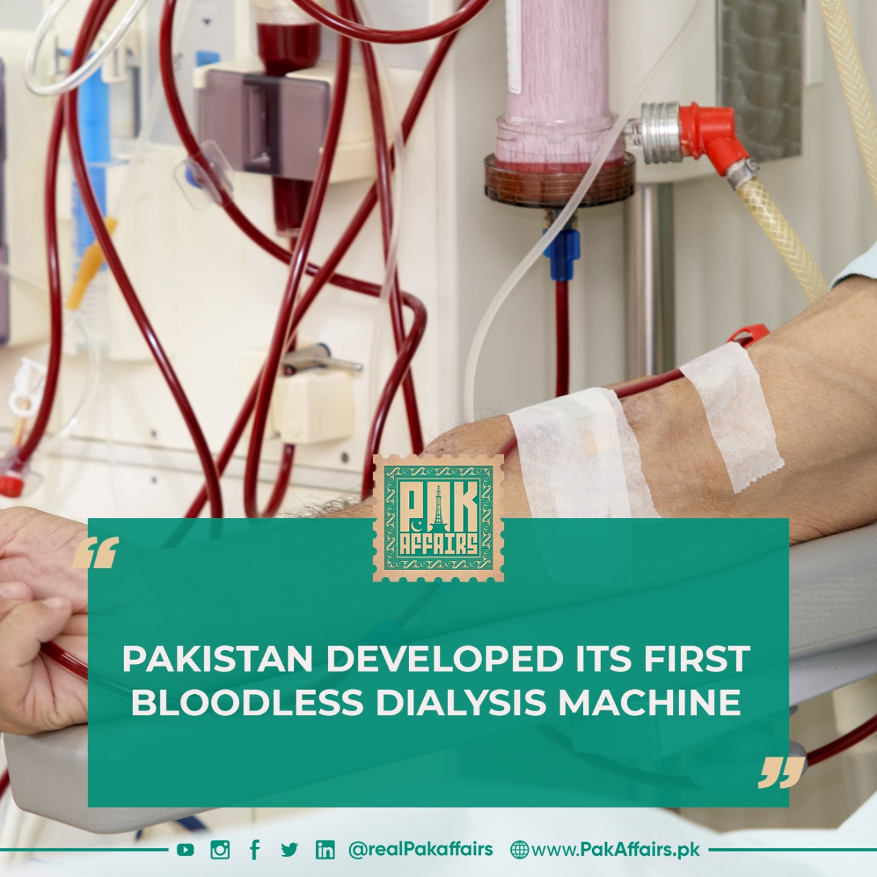 Pakistan developed its first bloodless dialysis machine