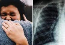 Chinese woman sued her male co-worker for hugging her too tightly, claiming that the hug broke three of her ribs Chinese woman sued her male co-worker for hugging her too tightly, claiming that the hug broke three of her ribs