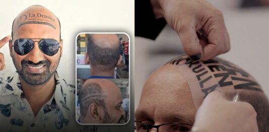 Now Men Will be Paid for their Baldness, Travel Vlogger’s Unique Ad Strategy Goes Viral Now Men Will be Paid for their Baldness, Travel Vlogger’s Unique Ad Strategy Goes Viral