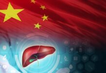 China Develops AI Tool for Detecting Liver Cancer Recurrence