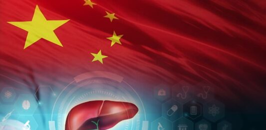 China Develops AI Tool for Detecting Liver Cancer Recurrence