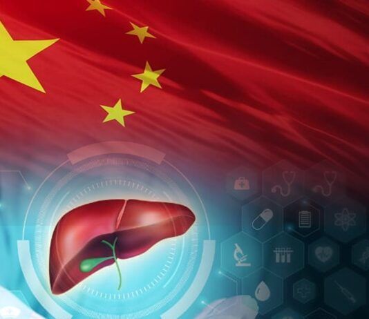 China Develops AI Tool for Detecting Liver Cancer Recurrence